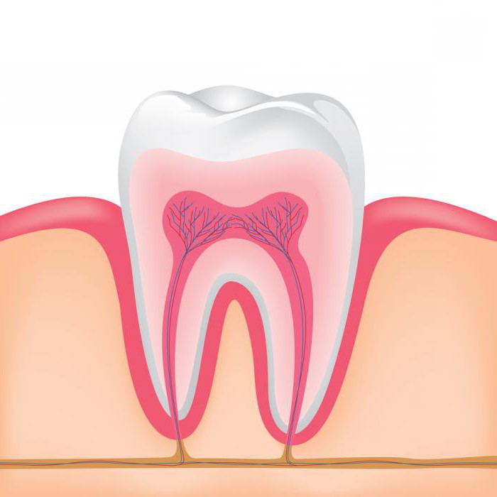 Как лечат воспаление корня зуба?