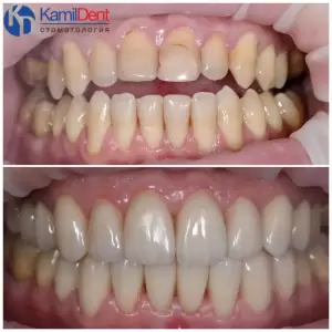 Фотография Камил Дент 4