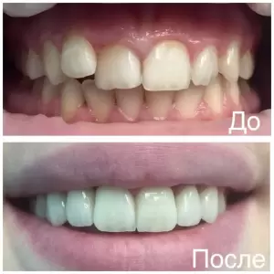 Фотография Камил Дент 1