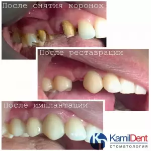 Фотография Камил Дент 2