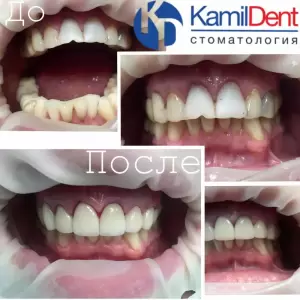 Фотография Камил Дент 3